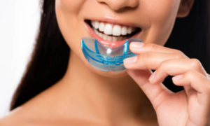 How To Find The Right Night Guard For My Teeth?