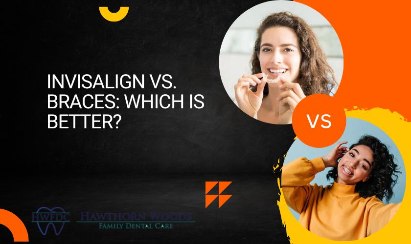 Invisalign vs. Braces Which Is Better?