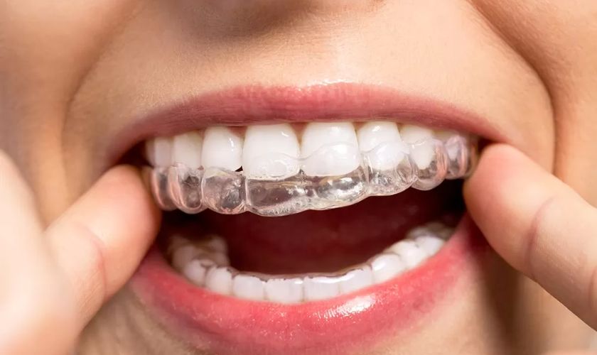 Invisalign in Hawthorn Woods