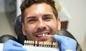 Patient comparing natural tooth shade with dental color guide samples during cosmetic consultation.