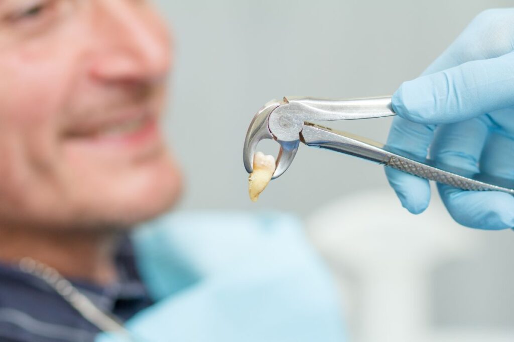 Tooth Extraction at Hawthorn Woods Family Dental Care