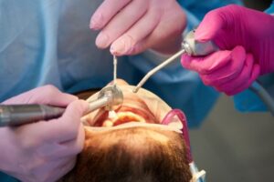 what-happens-if-you-delay-a-root-canal-for-weeks