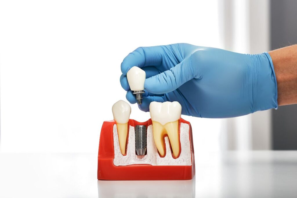 Dentist in Hawthorn Woods explaining how dental implants can prevent jawbone shrinkage