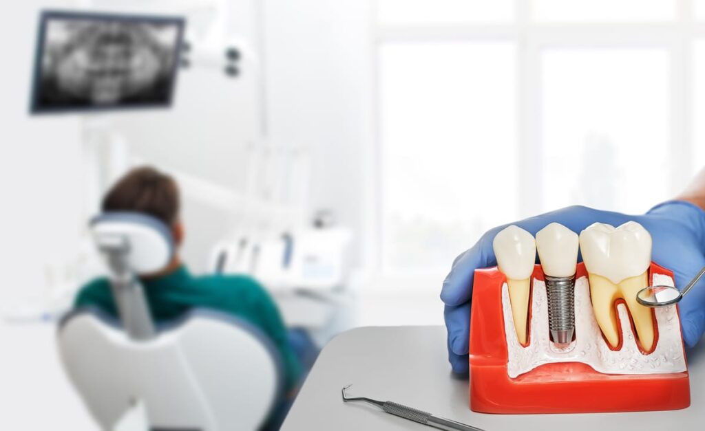 Dental implant model showing tooth replacement procedure with crown and titanium post in patient consultation.